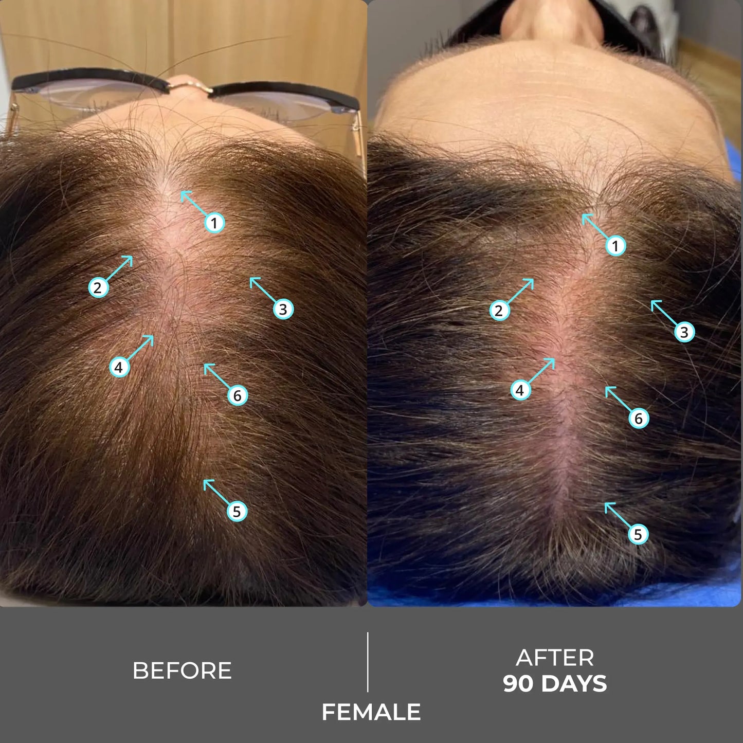 Extra Strength Hair DENSITY Shampoo