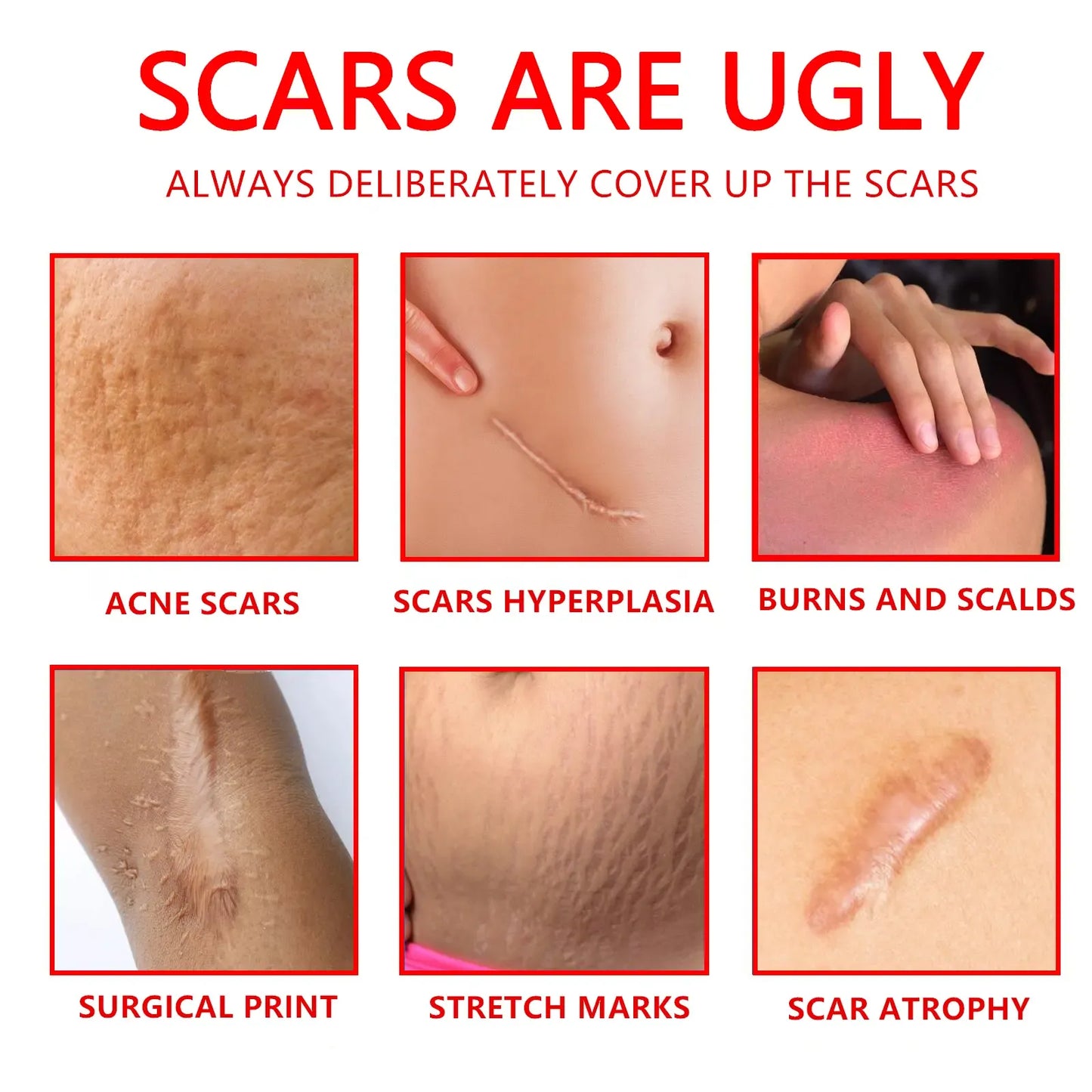 Professional and powerful scar removal gel - suitable for scar removal treatment of post-operative scars, caesarean section scars, keloids, burns, acne, etc.-A