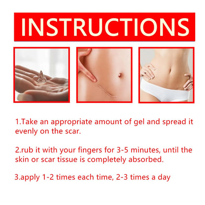 Professional and powerful scar removal gel - suitable for scar removal treatment of post-operative scars, caesarean section scars, keloids, burns, acne, etc.-A