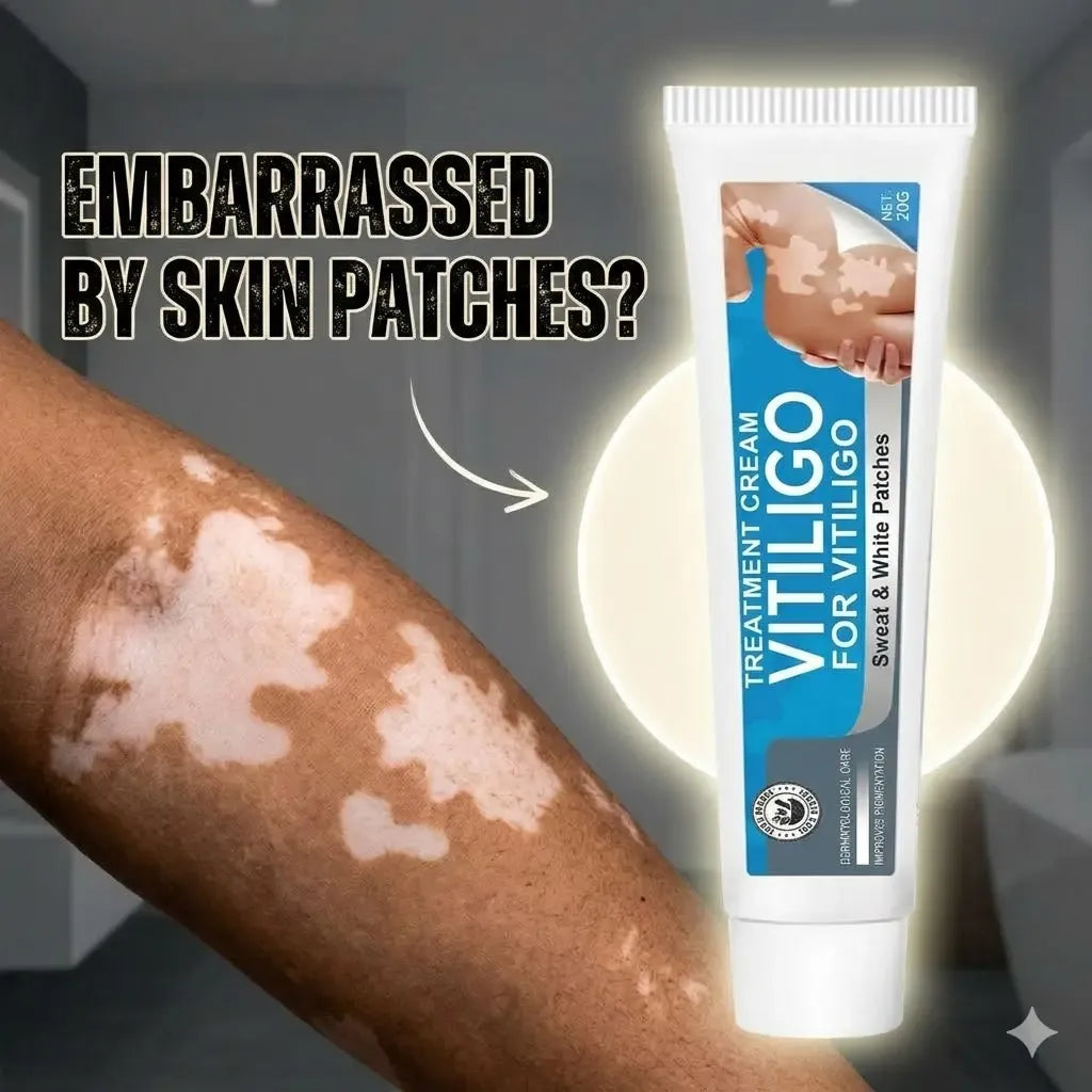 Vitiligo Cream, Natural Effective Vitiligo Treatment