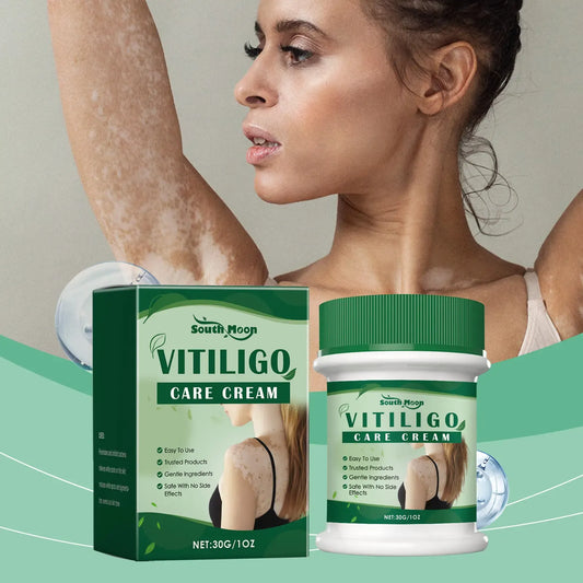 Vitiligo Treatment Cream, Improve Skin Pigmentation, Natural Formula, Suitable for All Skin