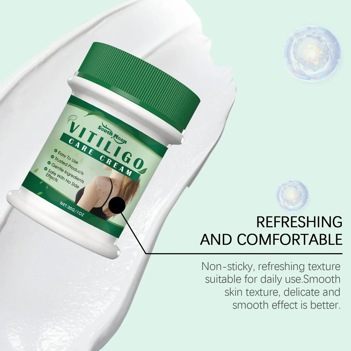 Vitiligo Treatment Cream, Improve Skin Pigmentation, Natural Formula, Suitable for All Skin