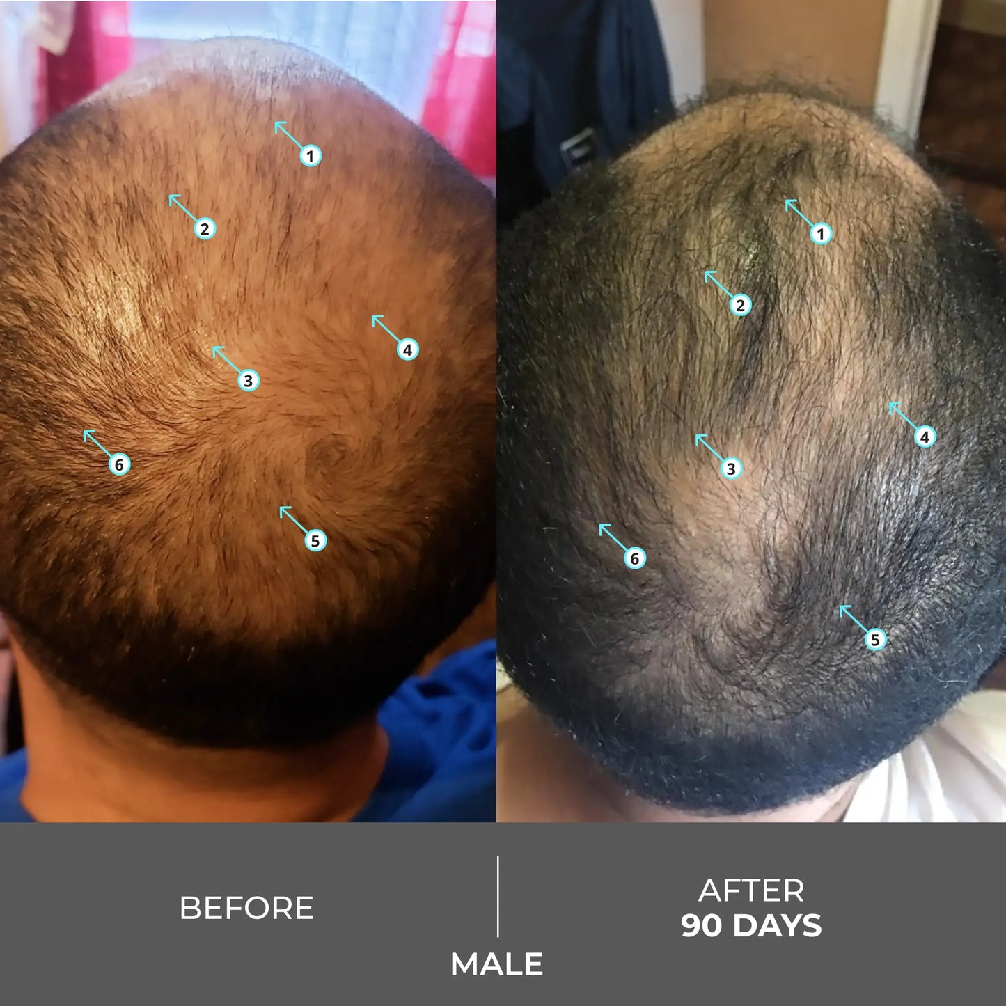 Extra Strength Hair DENSITY Shampoo
