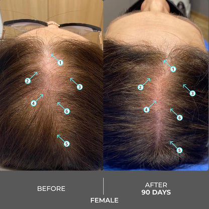 Extra Strength Hair DENSITY Shampoo
