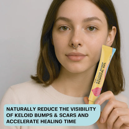 Keloid Bump Removal Gel | Natural Piercing Bump Treatment & Keloid Scar Gel | Keloid Scar Removal for all Scars, Keloids & Piercing Bumps | Soothing Piercing Aftercare | 2 oz